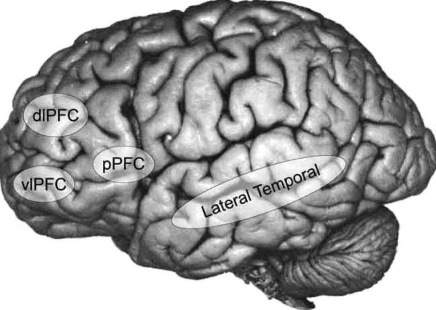 Lateral view of the brain. labelled regions include the