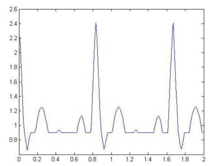 Figure 4 - from Study and Analysis of ECG Signal Using
