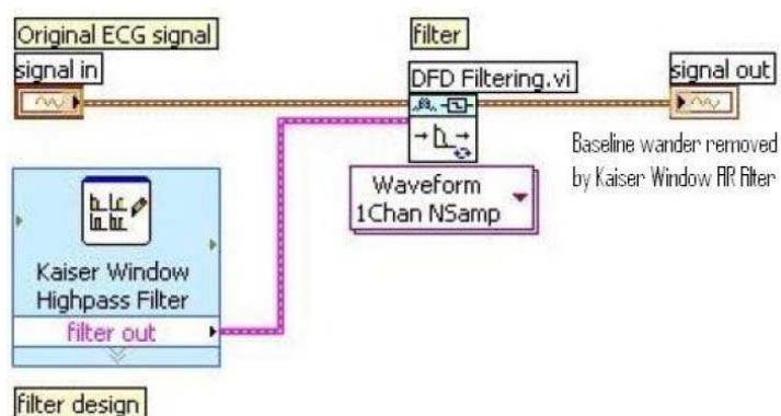 (PDF) Study and Analysis of ECG Signal Using MATLAB & LABVIEW as ...