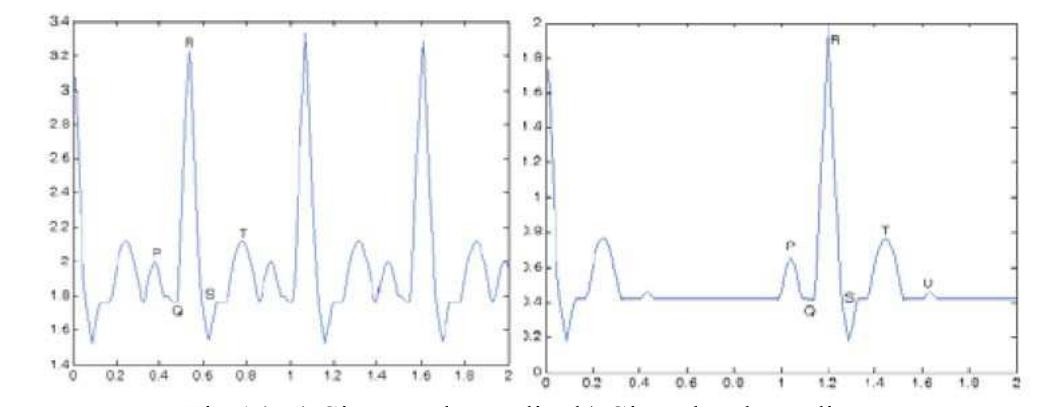 (PDF) Study and Analysis of ECG Signal Using MATLAB & LABVIEW as ...
