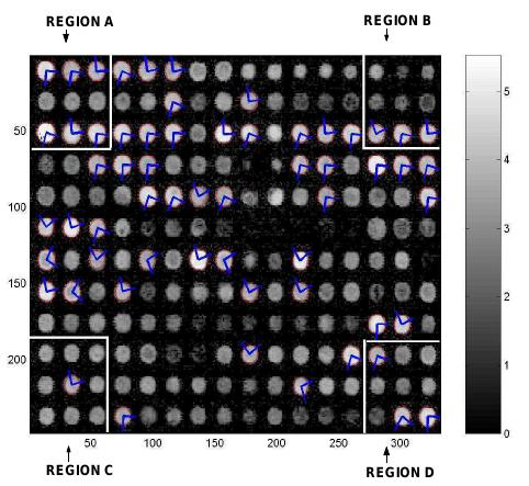 A gene microarray image with b-spline boundaries for each