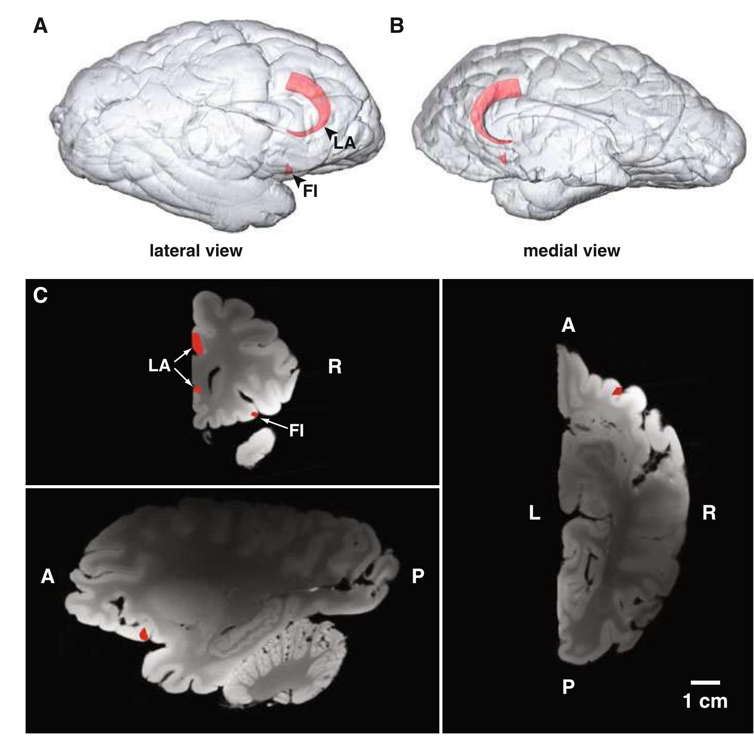 (PDF) The von Economo neurons in frontoinsular and anterior cingulate ...