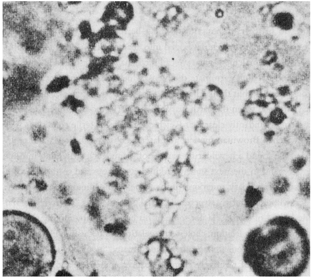 10rizon of scientific publication, and it is there we have to look to find what has become of Shrenberg’s “stomachs” or Leeuwenhoek’s “horses’ ears.” The early microscopists looked at die ind wondered “Who are we?” but the recent protozoologists look at the same organisms, whic dossess the same power to call into question concepts as fundamental as the nature, form, anc sexuality of the human body, and they ask about “semi-autonomy” and “degrees of lifferentiation.” Scientific terminology, italics and quotation marks have become the Procrust yeds of analogic thinking and imaginative metaphor. At the same time, they have effectively juelled the visual desperation that threatened early accounts by redescribing the failure of  analogy as a matter of language.  “vibrating ‘amoeba” (with “amoeba” in quotation 