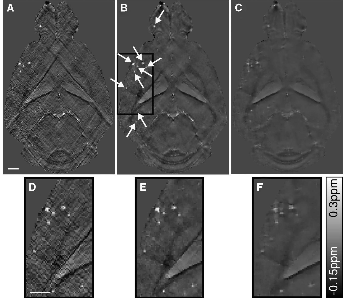 Figure 2 Quantitative susceptibility maps of an 18-month-old arcAf mouse brain data set computed with 6 = 0.05, 6 =0.5, an B=2.3 are presented in (A, D), (B, E), and (C, F), respectively. The bottom row (D-F) illustrates enlarged sections of th susceptibility maps, highlighted by the black box in (B). The scale bar indicates 1 mm. 