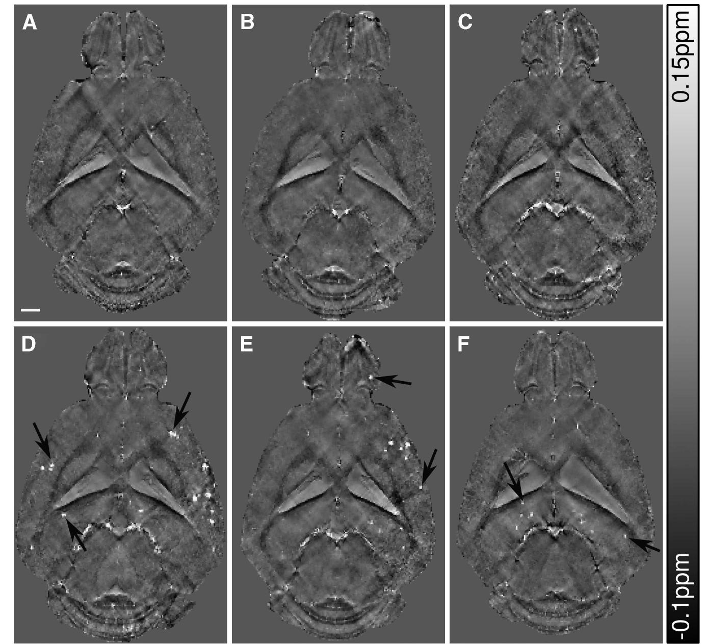 Figure 3 Horizontal quantitative susceptibility maps of three 18-month-old wild-type (wt) mice (A-C) and three age-matched arcA, (D-F) at a depth ~3 mm below the brain surface. Focal areas of high susceptibility, i.e., suspected cerebral microbleeds, are highl abundant in the arcAf mice (arrows). The scale bar indicates 1 mm. 