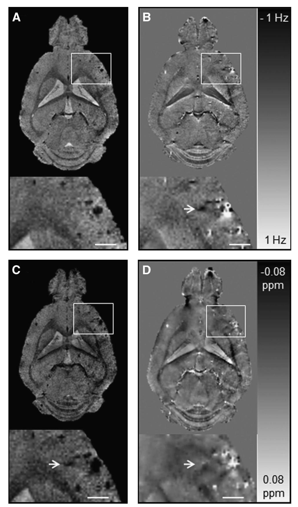 Figure 4 Comparison of gradient-recalled echo (GRE) magni- tude, phase, susceptibility-weighted imaging (SWI), and quanti- tative susceptibility mapping (QSM) of the brain of an 18-month- old arcAf mouse. Depicted are representative horizontal GRE magnitude (A), phase (B), SW images (C), and QSM images (D). The arrow points to a cerebral microbleed (CMB) that is discernible in the phase image, SWI, and QSM but not in the GRE magnitude image. The CMBs are more confined in QSM than in magnitude, phase, and SW images that show strong blooming effects. The scale bar indicates 1 mm. 