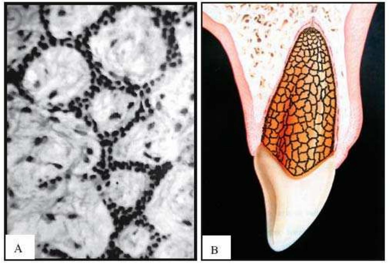 Figure 1 - from The epithelial cell rests of Malassez - a