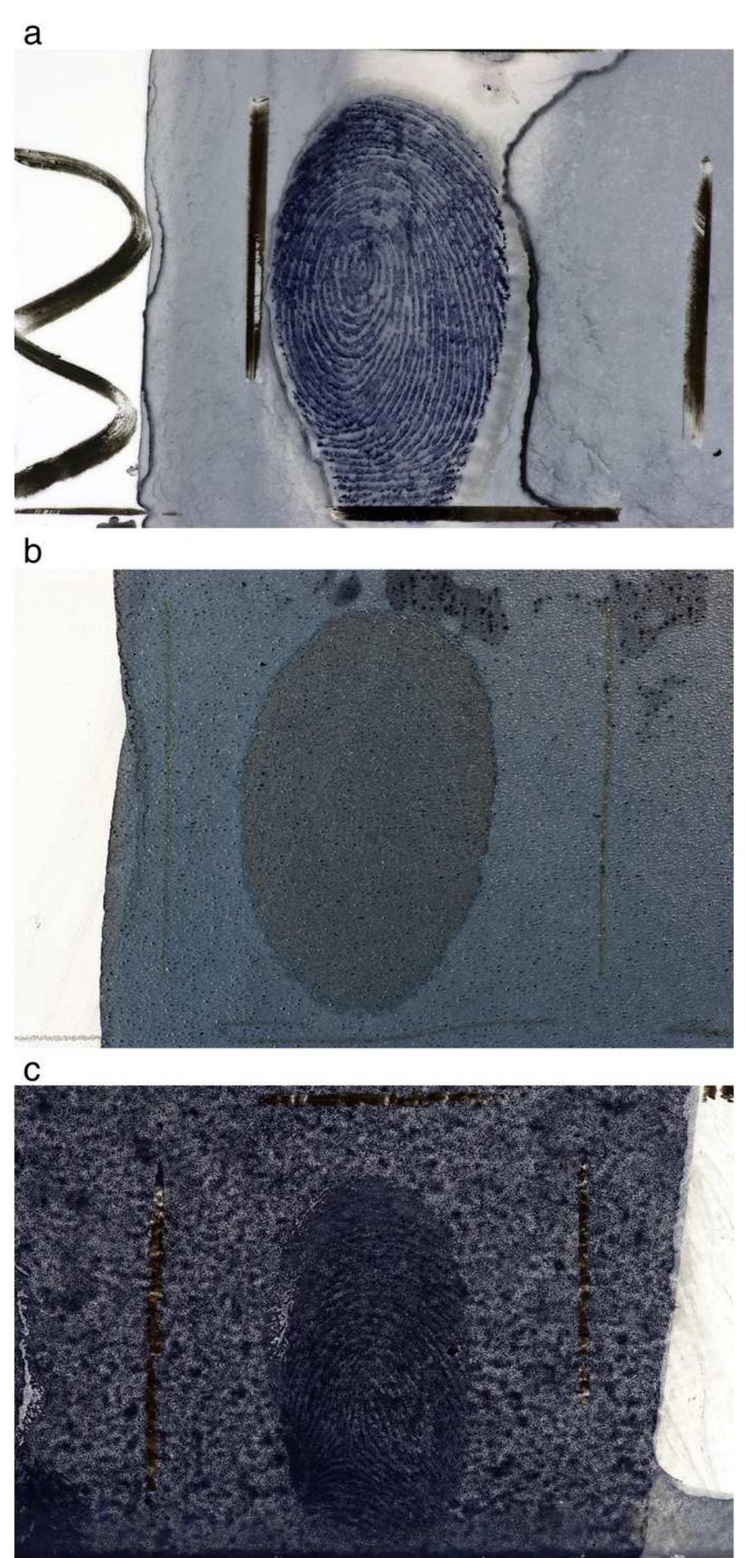 Examples of different levels of background staining, a)