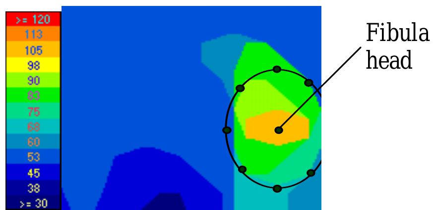 Pressure Map Examples 3: pressure map example from f-scan software (with values in
