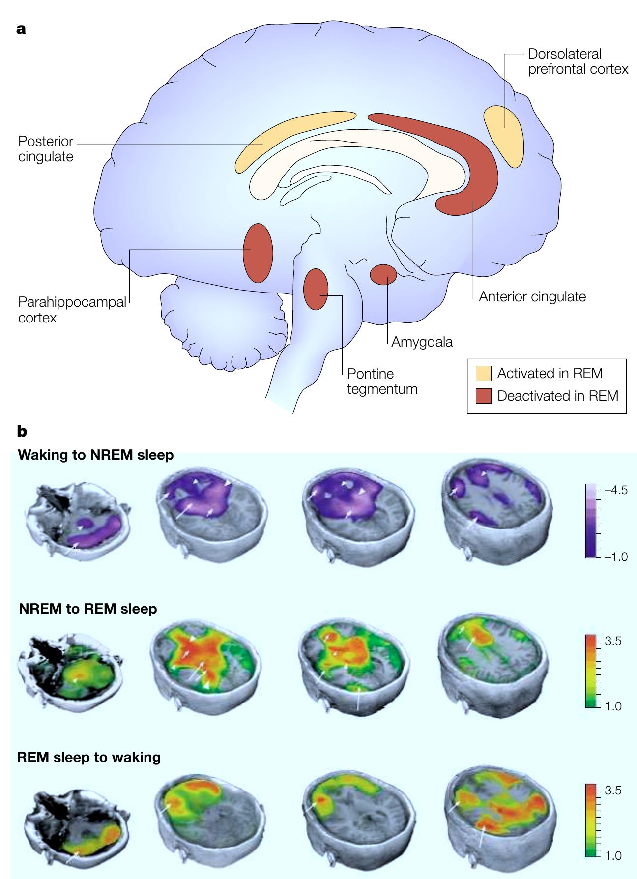 Figure 4 - from Hobson (2005) Cognitive Neuroscience of