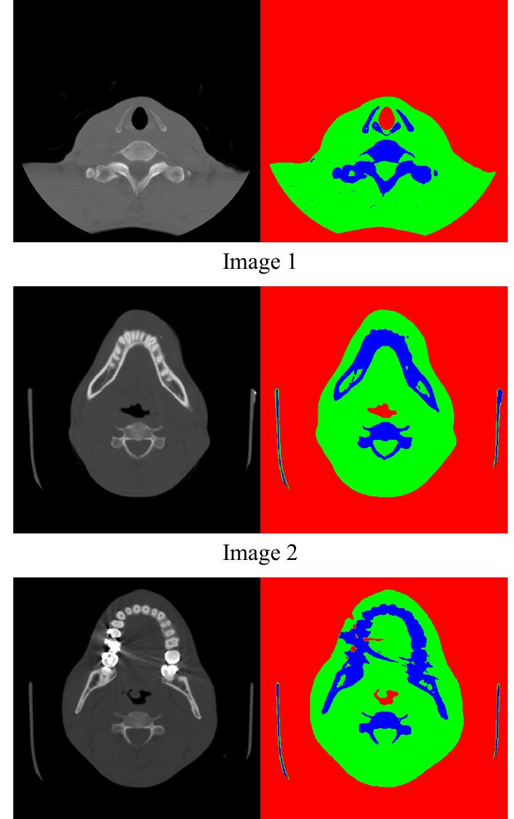(PDF) Medical Image Segmentation using Multi-Agent System Approach