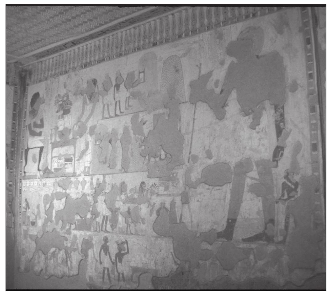 of the temple at Kom Ombo that depicts medical paraphernalia (NUNN 1996: 163-5, fig. 8.2).  Although the jars and sacks carried by the men and women depicted in the lower two registe1 are not perhaps unusual, it is interesting to note that the jar carried by the foremost woman i the third register is of the same type as that held by the servant offering to the Syrian dignitarn In addition, this jar and the sacks carried by several people in the scene, including the attendan resemble those depicted in a scene from the Ramesside tomb of Ipwy at Deir el-Medina (TT217 Davies 1927: pl. XXXVII-III; Fig. 10). Nunn (1996: 56-7 with fig. 3.6, 201) suggested that th entire scene displays a satire on workplace injuries, and Westendorf (1999: 472) views this as th only tomb depiction of a physician at work. The portion to be compared with Nebamun’s tom scene occurs in the lower left corner where a man with boxes, a sack and a jar placed nearb holds a long stick against a craftsman’s eye. Although some scholars have interpreted this a depicting a man re-applying kohl paint to a craftsman’s eye (e.g., O’CONNoR, pers. comm.), | seems more likely that it depicts a craftsman who has suffered an eye injury of some sort and i being treated for it by a physician. The physician uses a stick to apply a remedy that probabl was made by mixing a powder contained in the sack with a liquid in the jar, all of which wer brought in the box placed above him (cf. NUNN 1996: 201). Indeed, the treatment of eye injurie is discussed in a section of the Ebers papyrus (336-431), where many of the prescriptions an remedies involve applying to the eye a mixture of eye-paint, ground food, minerals and liquid (NUNN 1996: 197-202; WESTENDORE 1999: 146-56, 609-624). 
