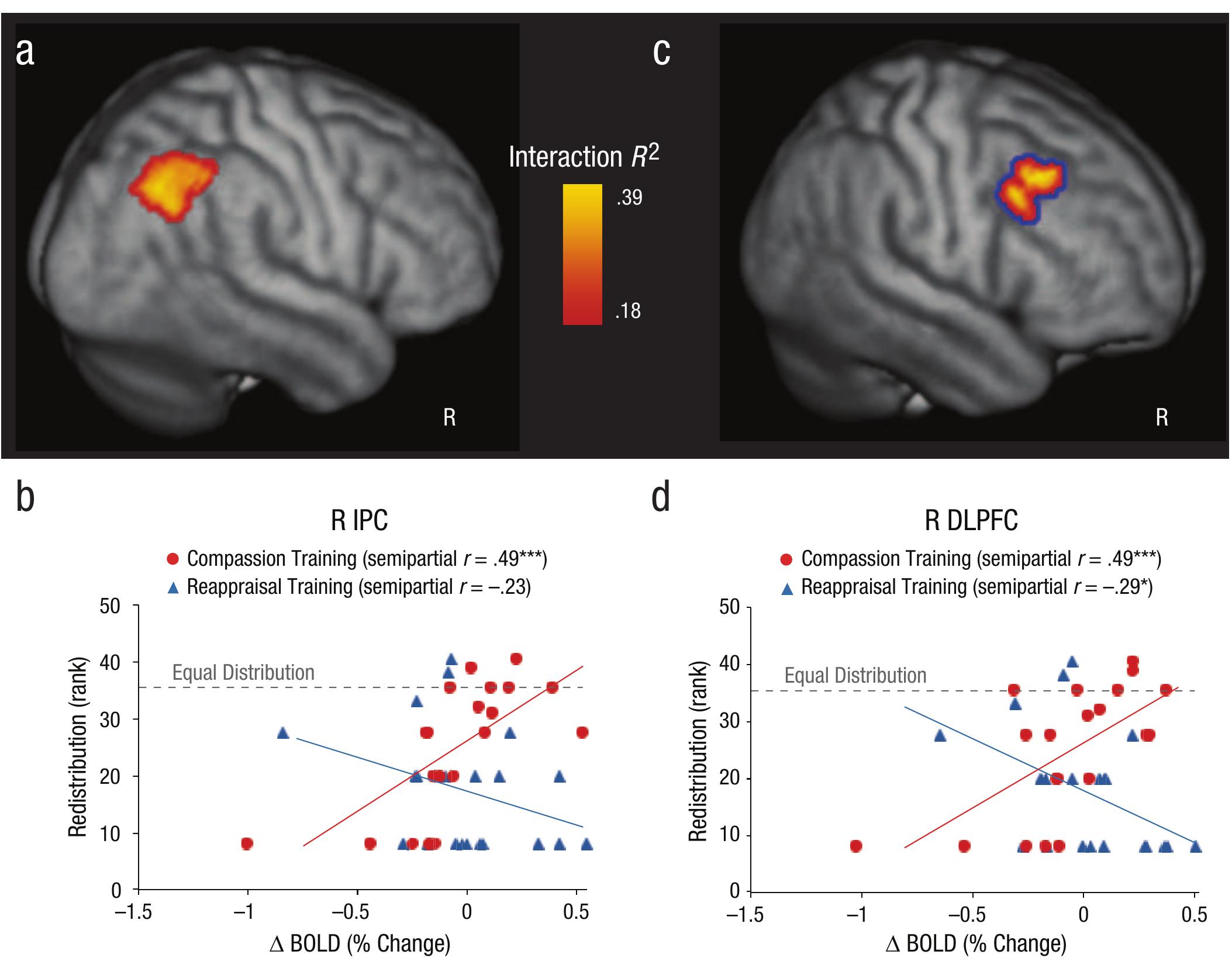 Activation in right inferior parietal cortex (pc) and right