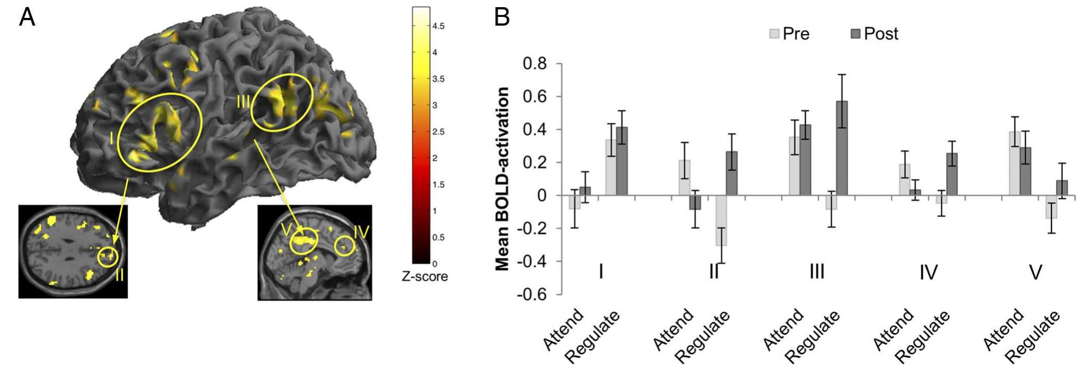A, the figure shows brain areas that showed greater bold
