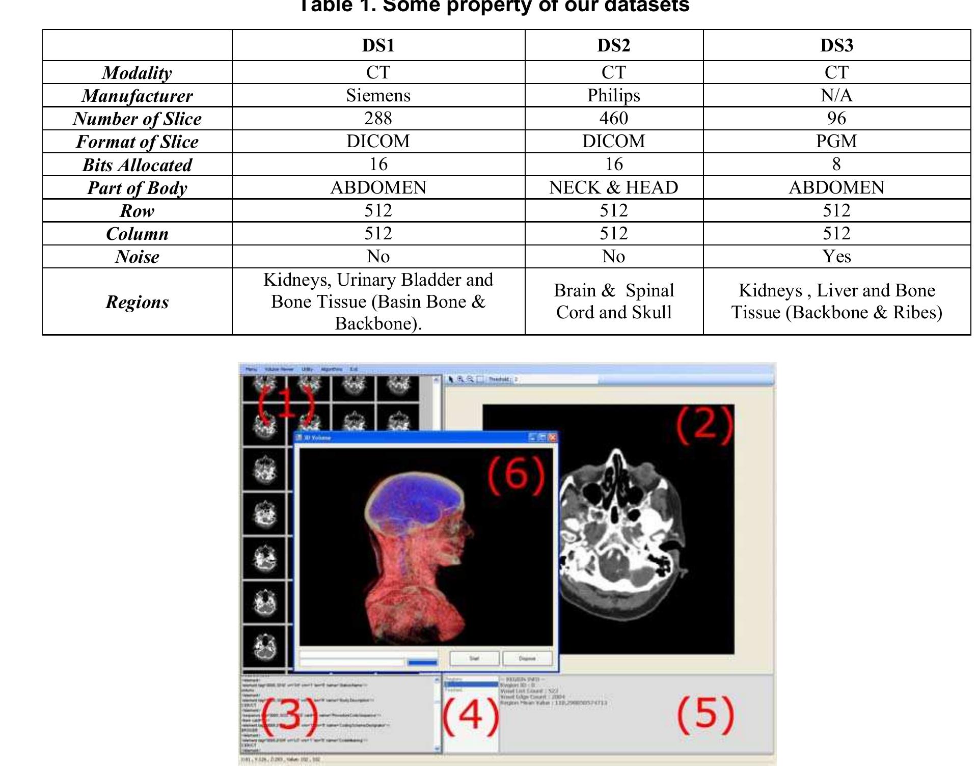(PDF) Comparison of 3D Segmentation Algorithms for Medical Imaging