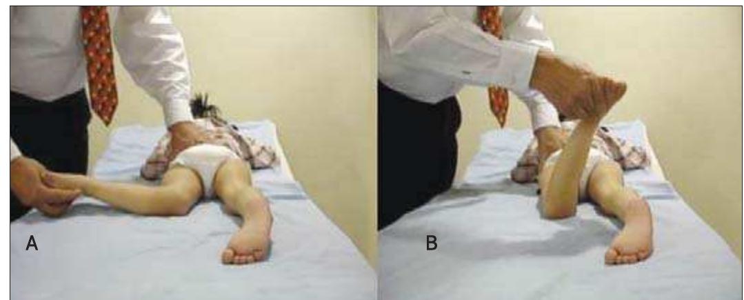 Testing femoral anteversion in clinic by measuring the angle