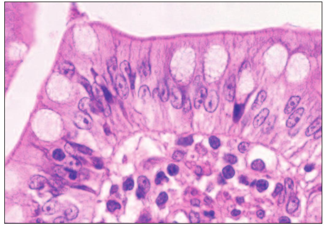 Instestine Pattern 1. a well-fixed and well-processed section of small