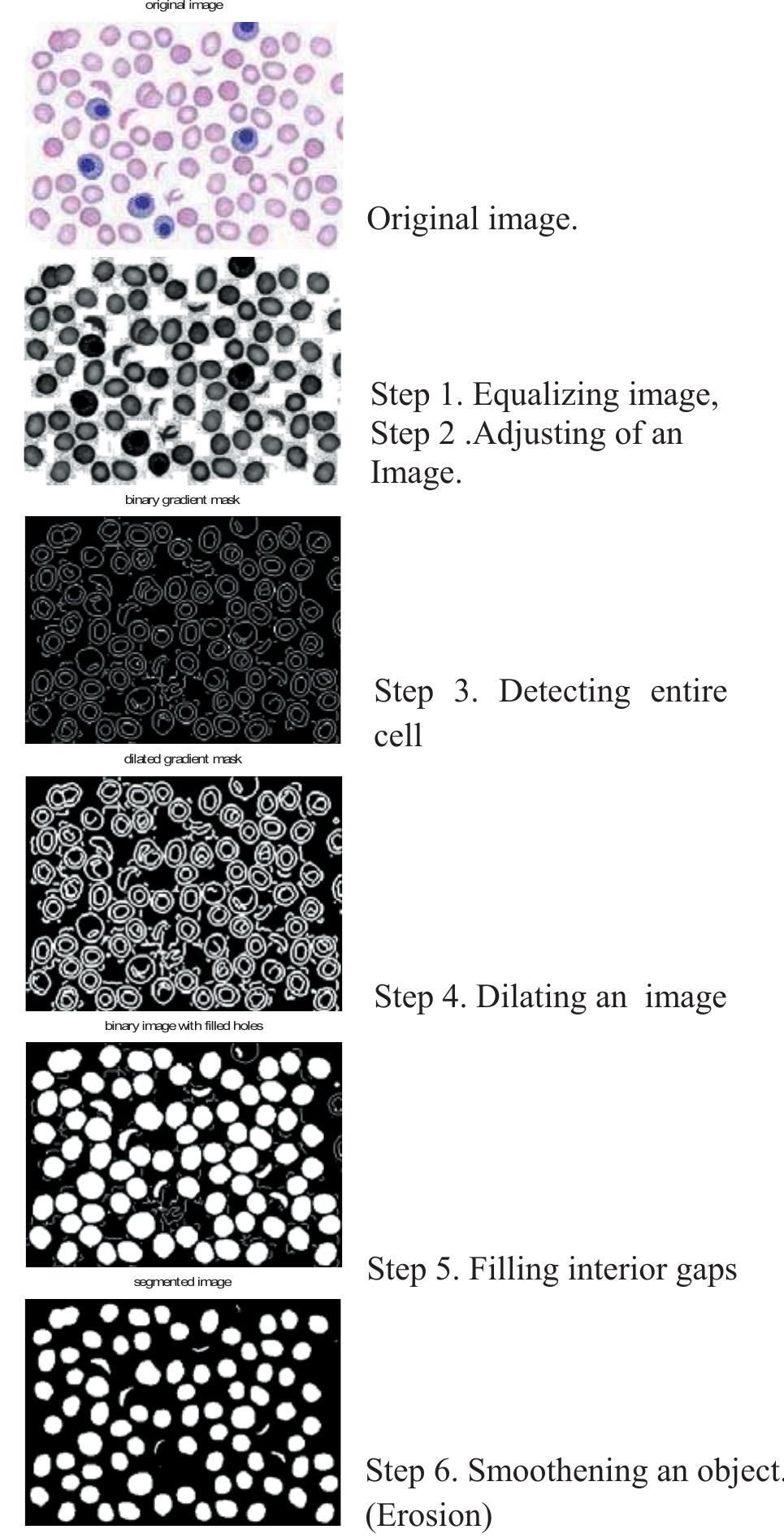 Figure 2 - from RED BLOOD CELLS EXTRACTION AND COUNTING IEEE