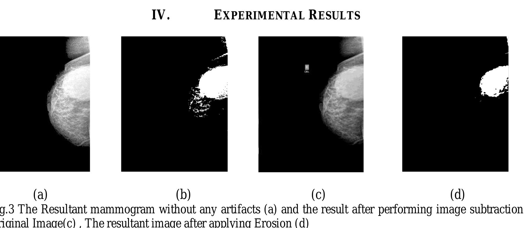 (PDF) Detection of Malignancy in Digital Mammograms from Segmented ...