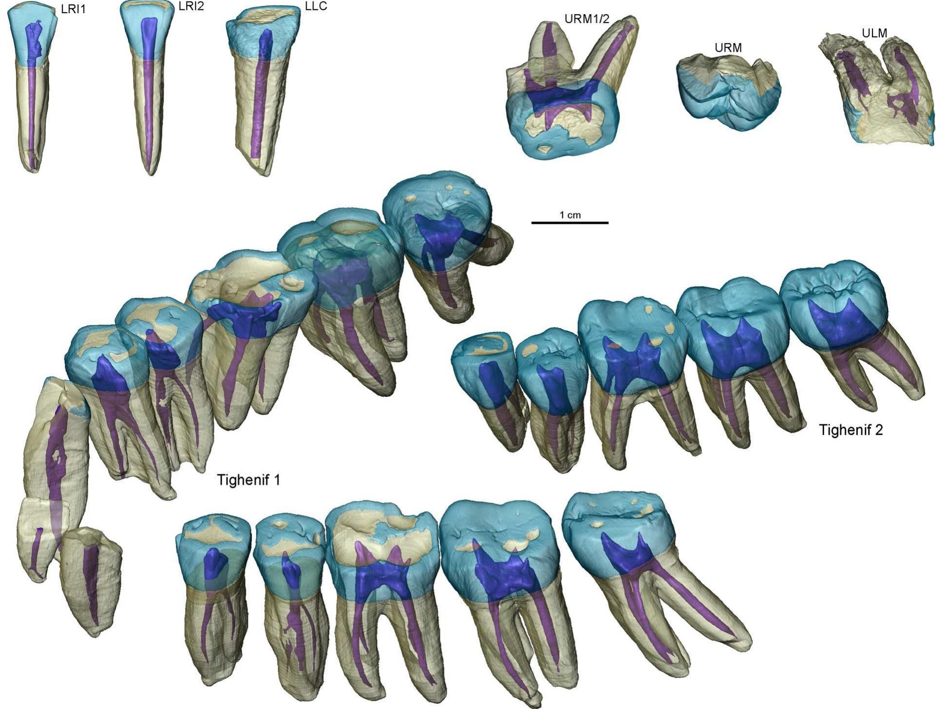 Fig. 1. Microtomographic-based 3D reconstruction of six isolated teeth from Tighenif (top) and of the virtually extracted tooth elements from the mandibles Tighenif 1 (left) and 2 (right), with the enamel and dentine rendered in transparency thus highlighting the pulp cavities. In Tighenif 1, the virtually extracted root fragments residual of the LRI1 and LLI2 are also shown. Colour available online.  Fig. 1. Reconstruction microtomographique 3D de six dents isolées de Tighenif (haut) et des éléments dentaires virtuellement extraits des mandibules Tighenif 1 (gauche) et 2 (droite), avec l’émail et la dentine en transparence, permettant ainsi la visualisation de leurs cavités pulpaires. Chez Tighenif 1, les fragments virtuellement extraits de racine de la LRI1 et de la LLI2 sont aussi montrés. Couleur disponible en ligne. 