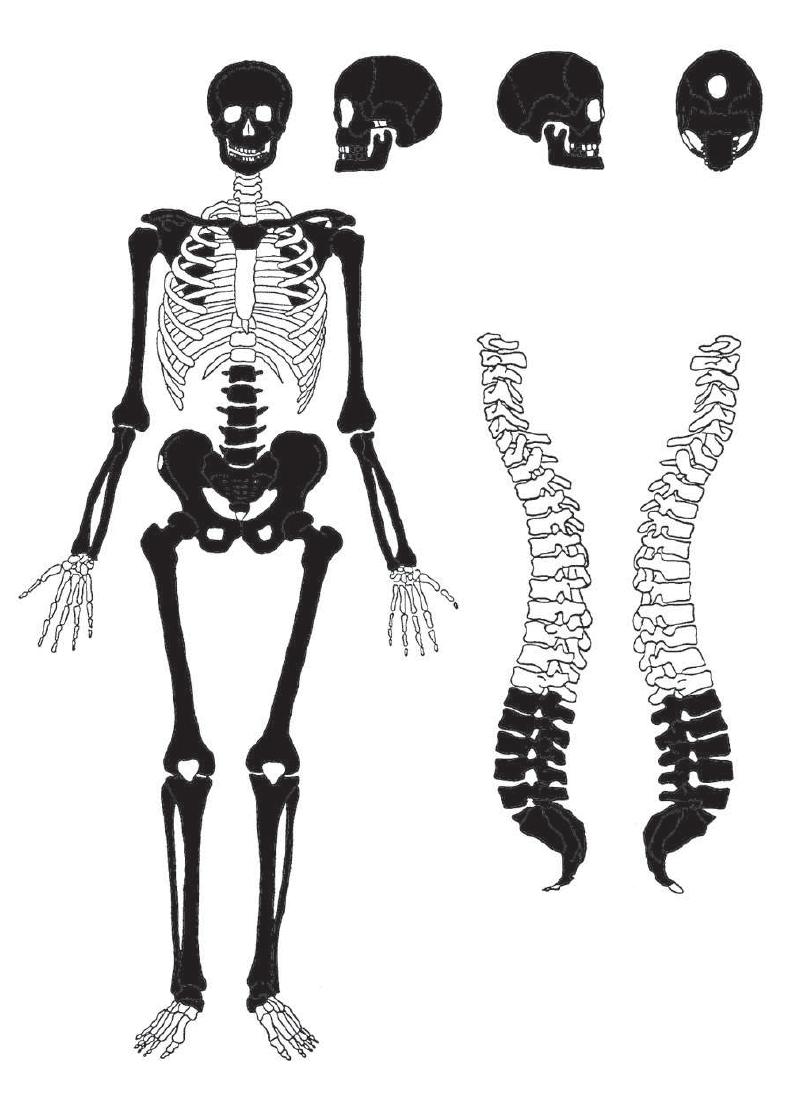 Grave goods - a bronze needle and an iron pin were situated