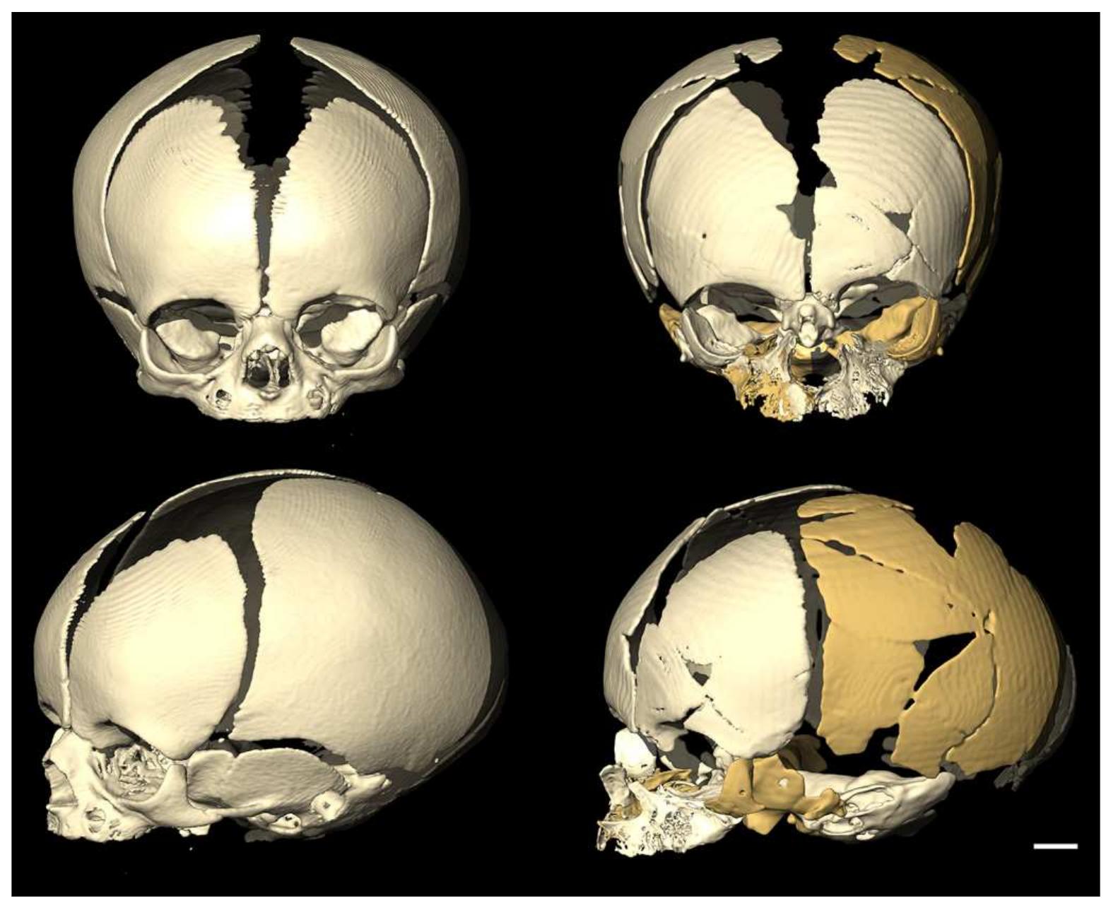 Neoteny Examples Human Figure 4 - from A uniquely modern human pattern of