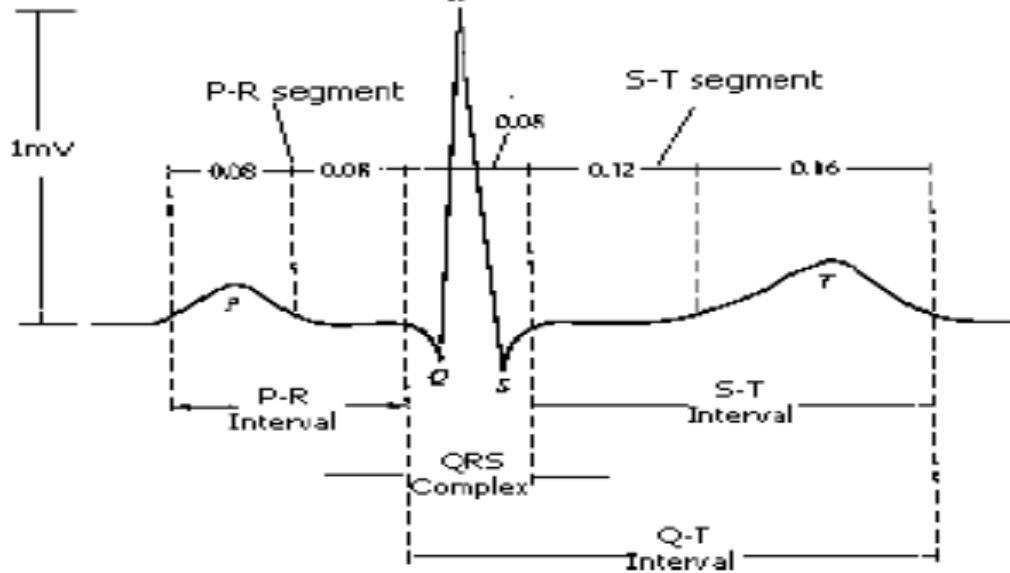 Ecg Pan Algorithm Pattern analysis of different ECG signal using Pan-Tompkin’s algorithm