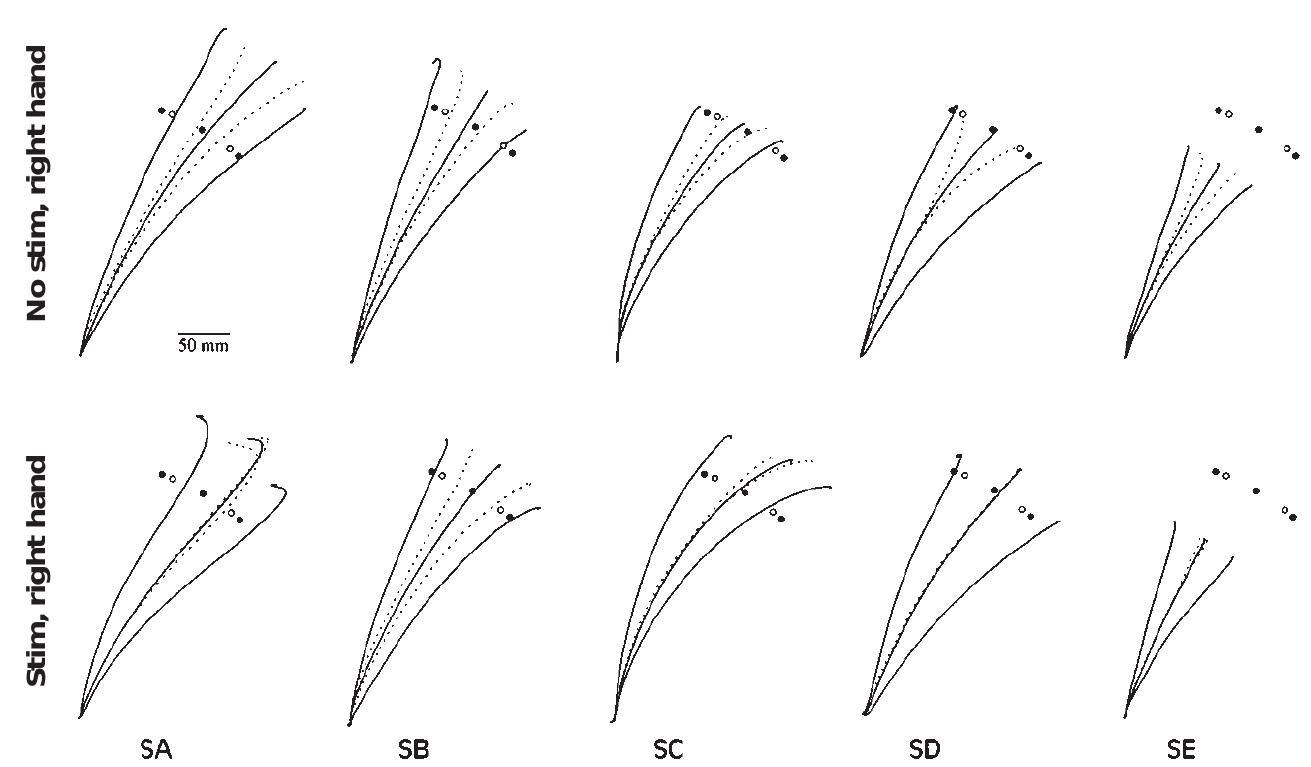 (PDF) Role of the posterior parietal cortex in updating reaching ...
