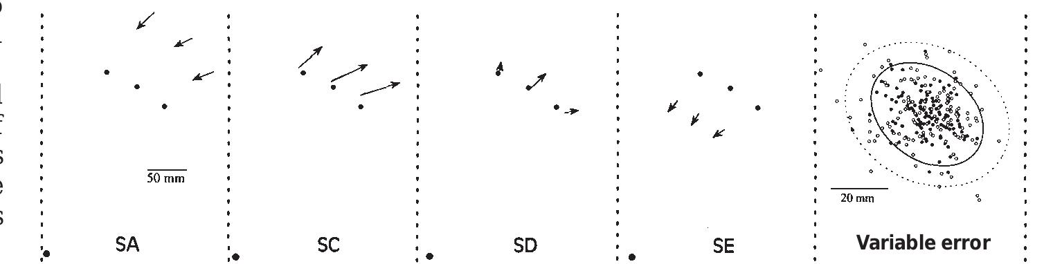 (PDF) Role of the posterior parietal cortex in updating reaching ...