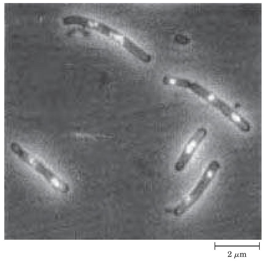 -36 e. coli cells showing nucleoids. the dna is stained with