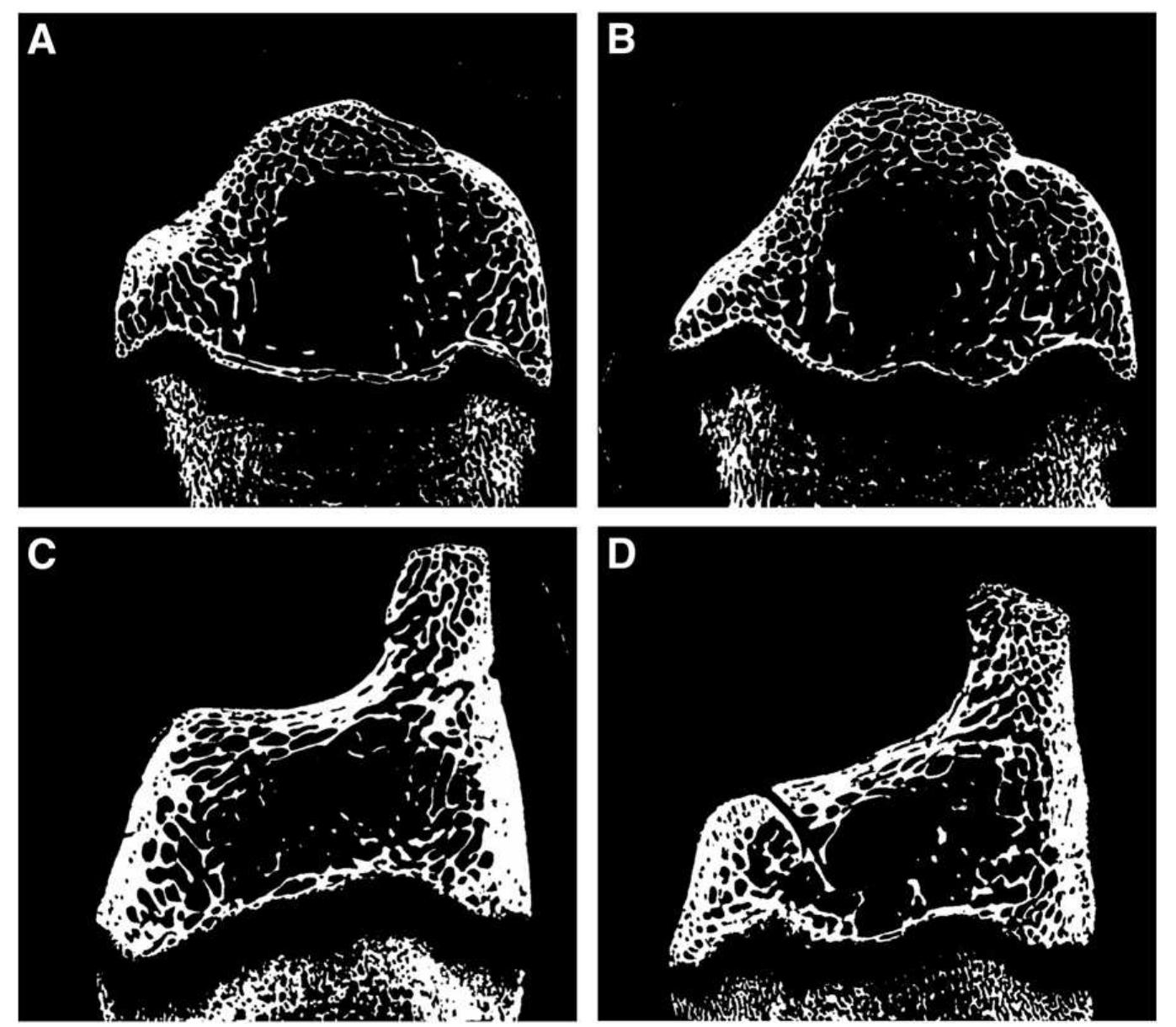 Sadgital Ridge Sagittal 2d sections of distal radii (figs. 10a and b) and