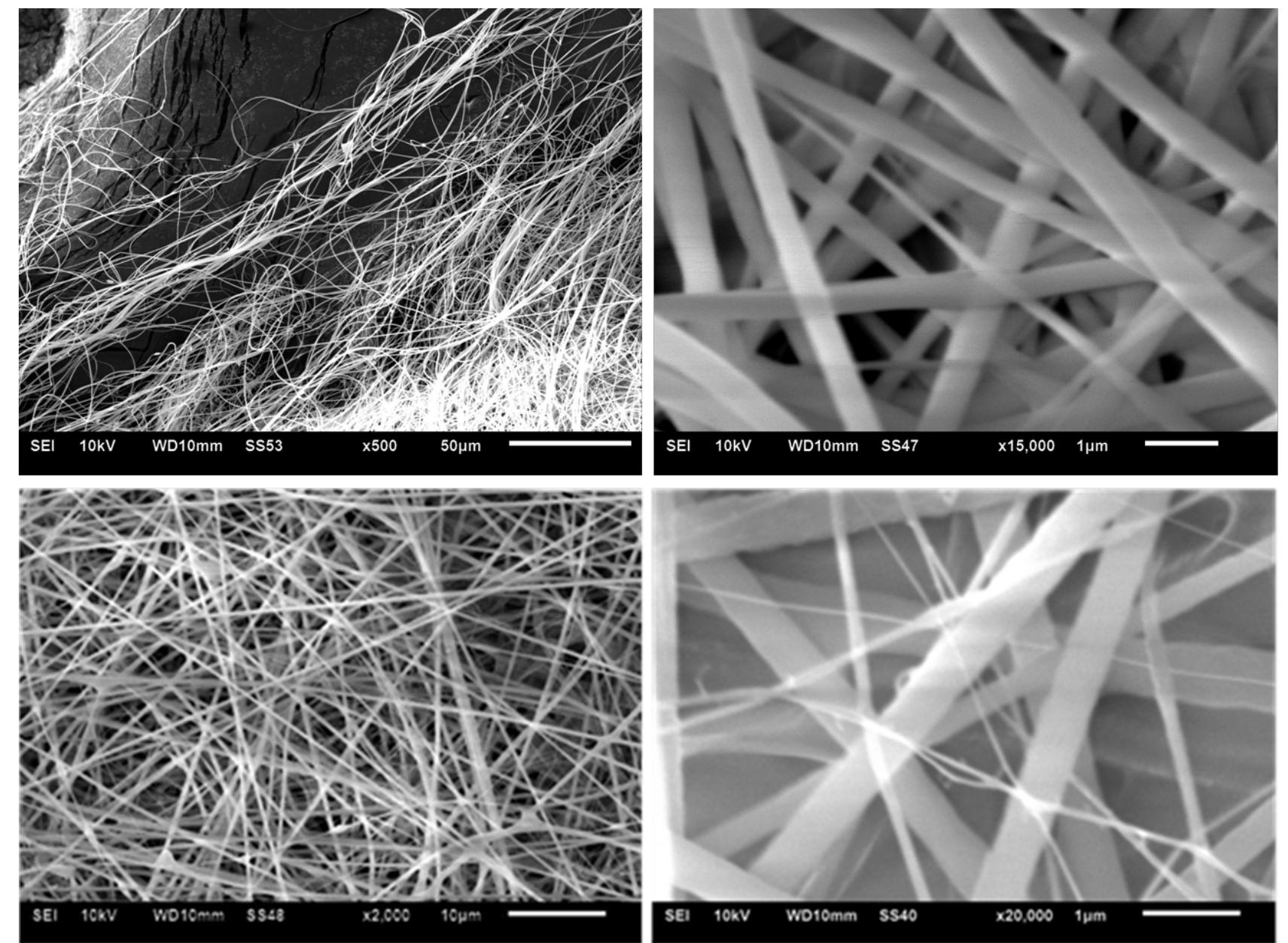 (PDF) Carbon nanofibers Containing Ag/TiO2 Composites as a Preliminary ...