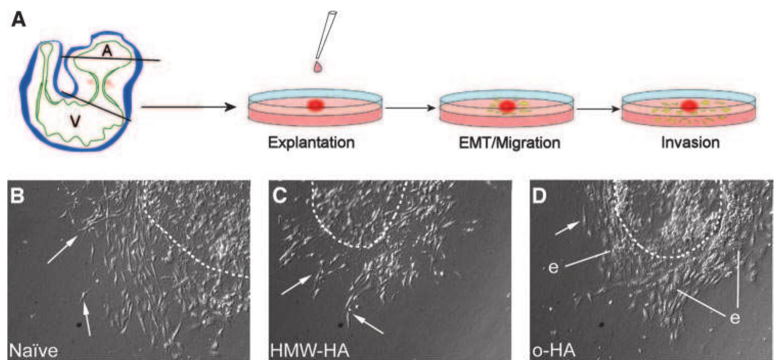O-ha attenuates endocardial cushion emt. a, schematic