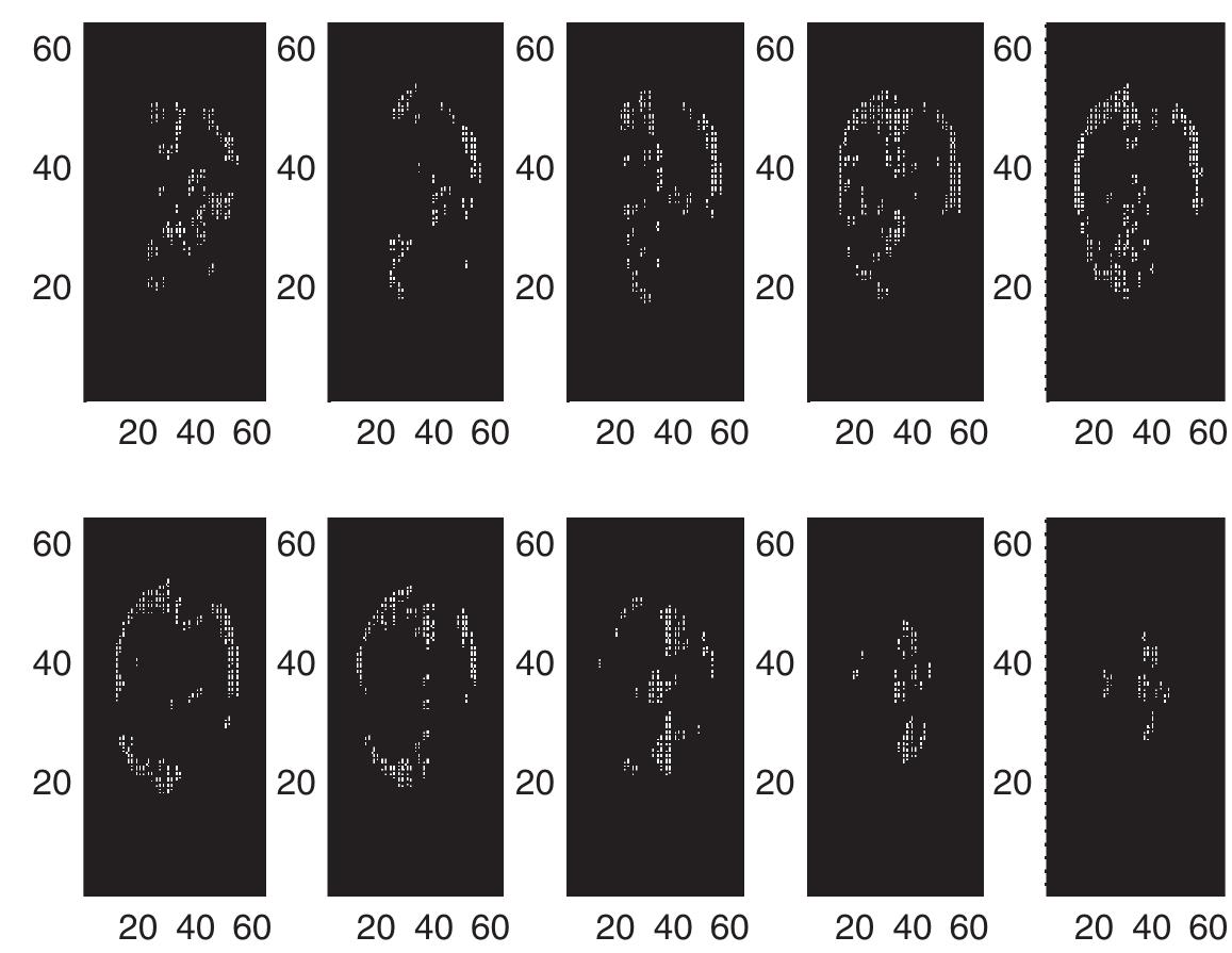 3 _ statistical parametric maps of activation (p