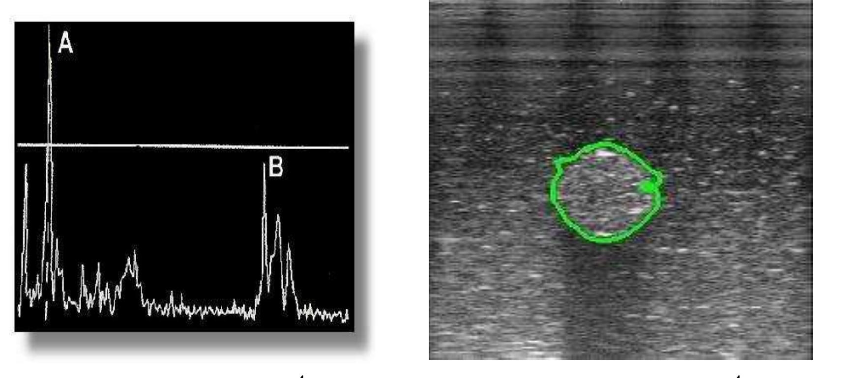 (PDF) Basic of ultrasound imaging