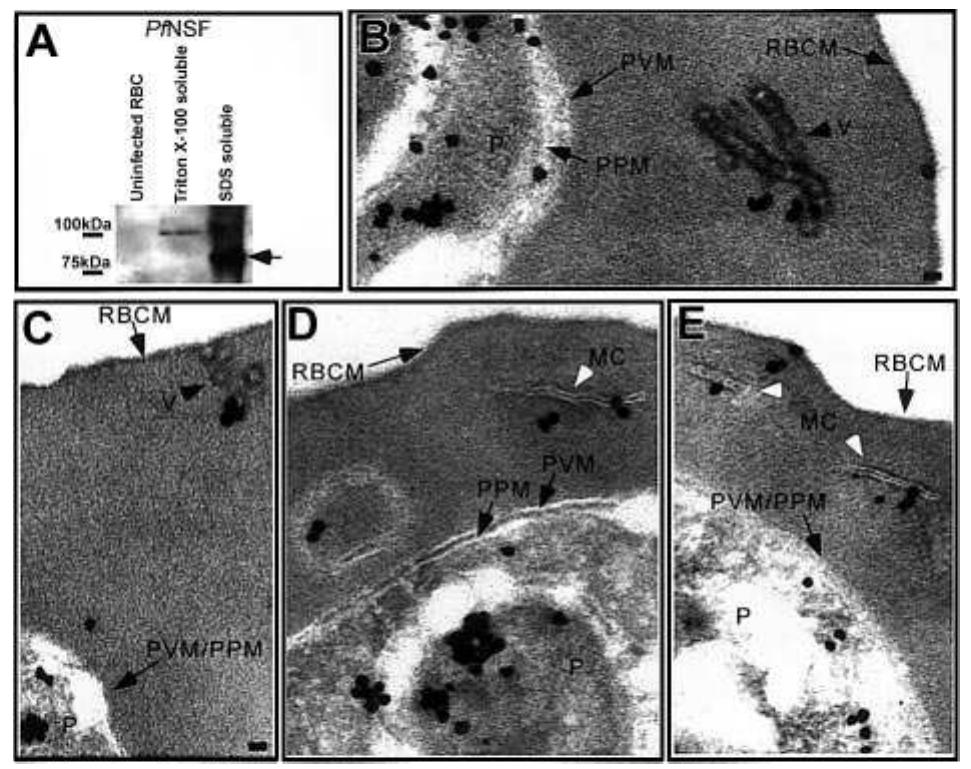 Figure 4 - from Generation of an erythrocyte vesicle