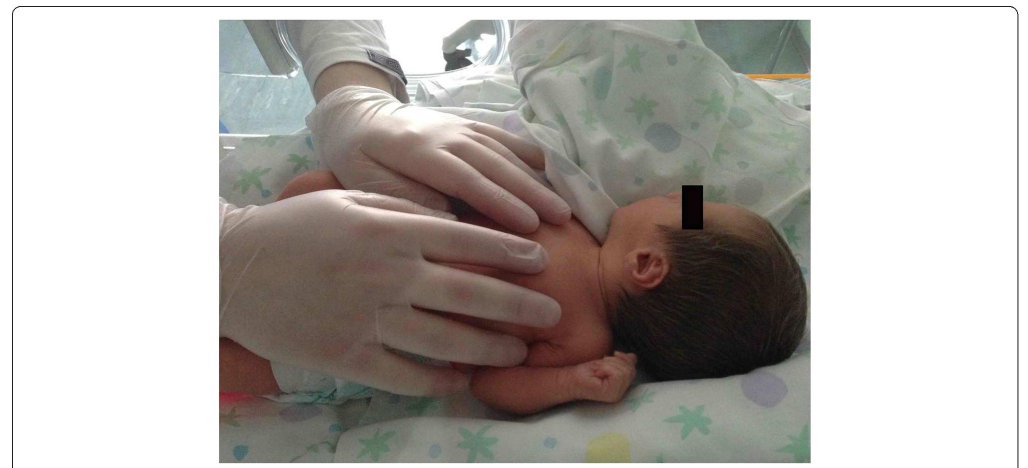 Assessing Rib Mobility (PDF) Introducing an osteopathic approach into neonatology ward: the NE ...