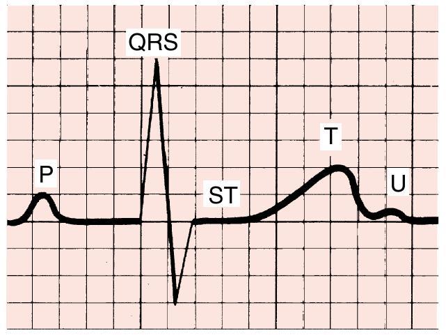 -2. the p wave represents atrial depolarization. the pr