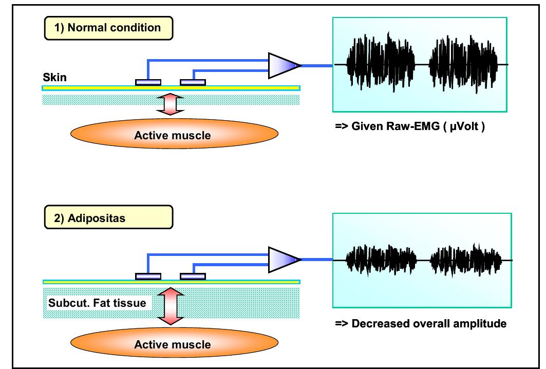 (PDF) ABC of EMG