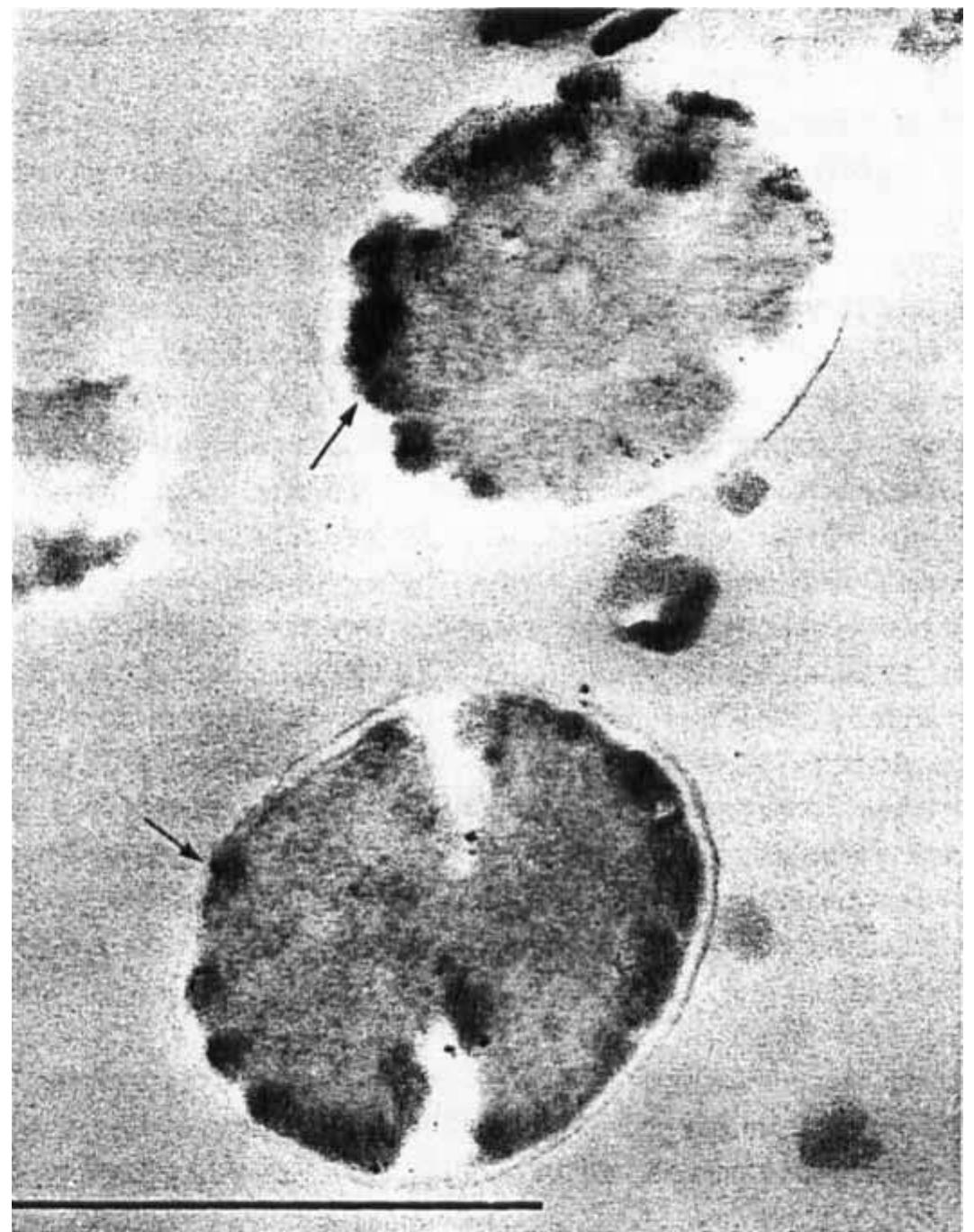 Urease Producting Bacteria (PDF) The Ecology and Pathogenicity of Urease-Producing Bacteria in the ...