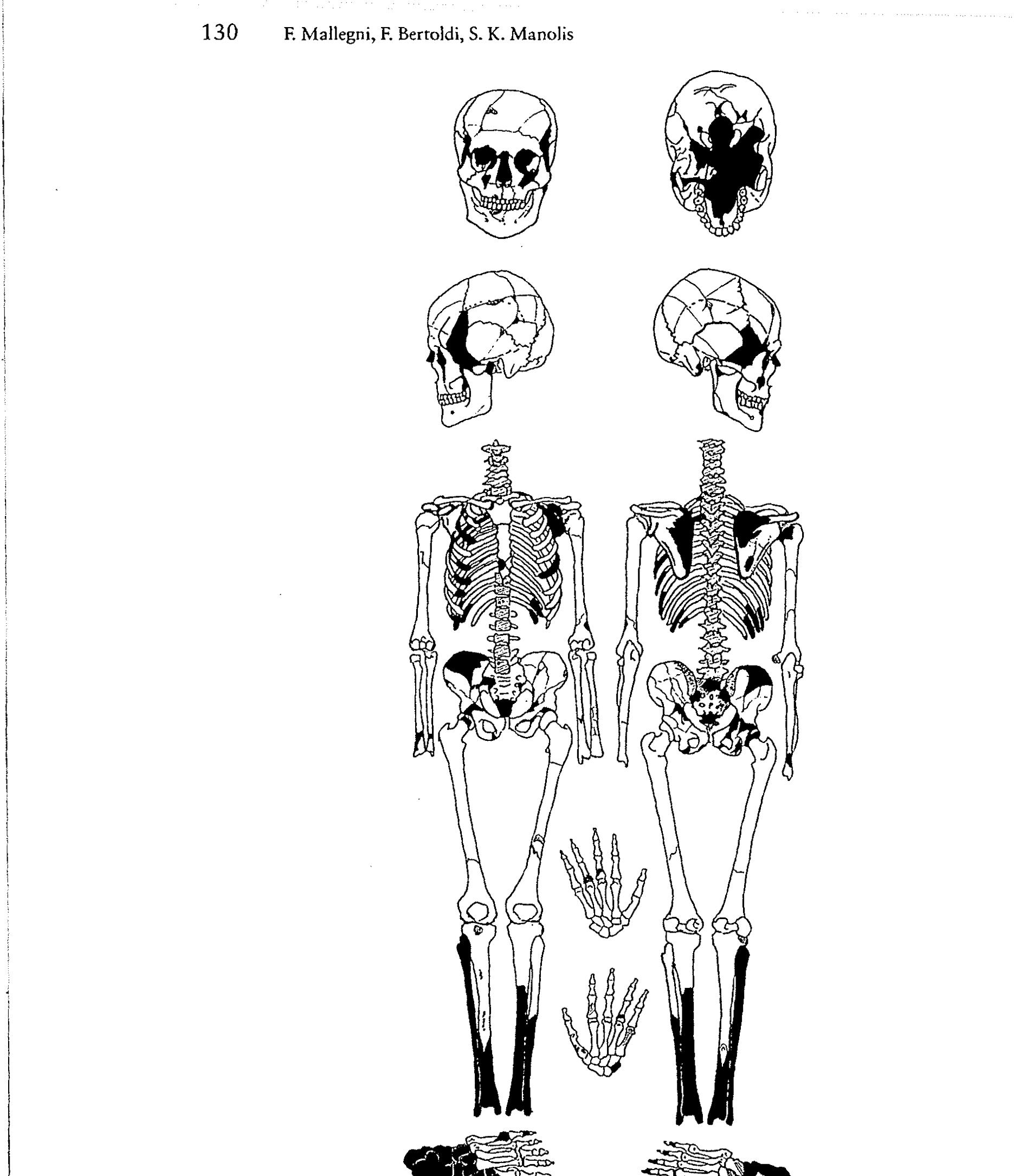 Figure 3 - from The Gravettian female human skeleton from