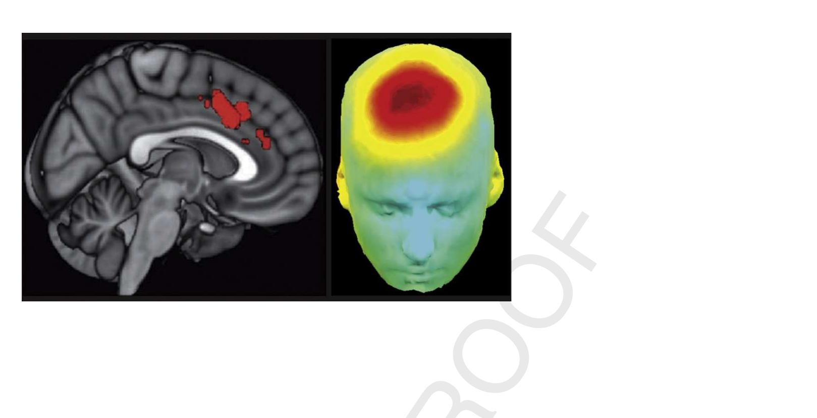 Figure 1 - Frontal midline theta reflects anxiety and