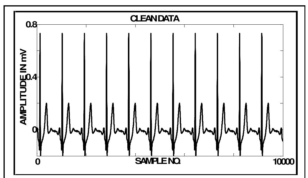 ECG Noise Reduction Using Fourier Coefficient Suppression