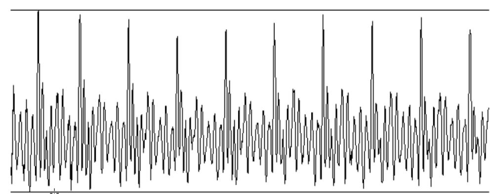 Figure 5 - Speech Recognition with Dynamic Time Warping