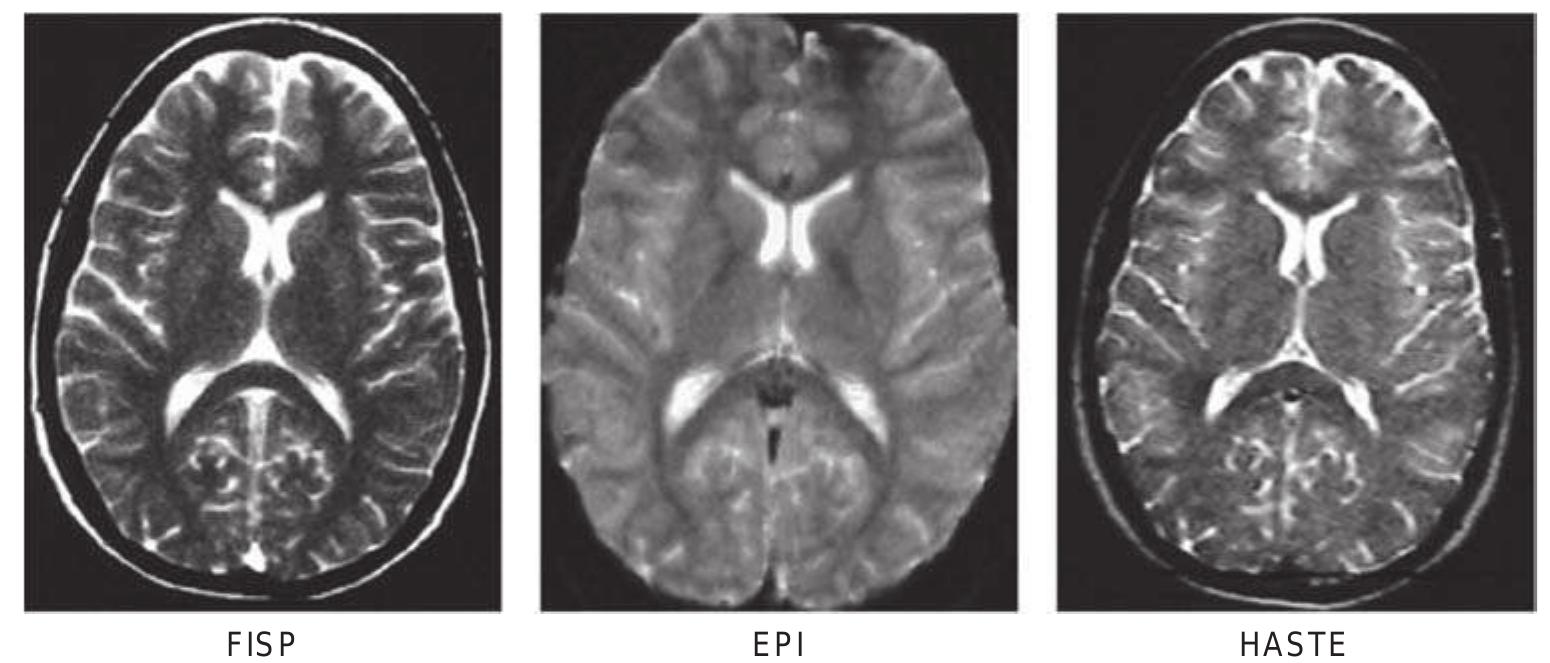 Figure 29 - from Introduction to Functional Magnetic