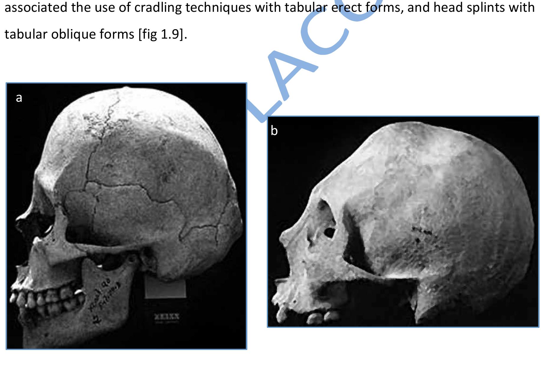 Maya Drooping (PDF) Undergrad Dissertation - Artificial Cranial Deformation in Maya ...