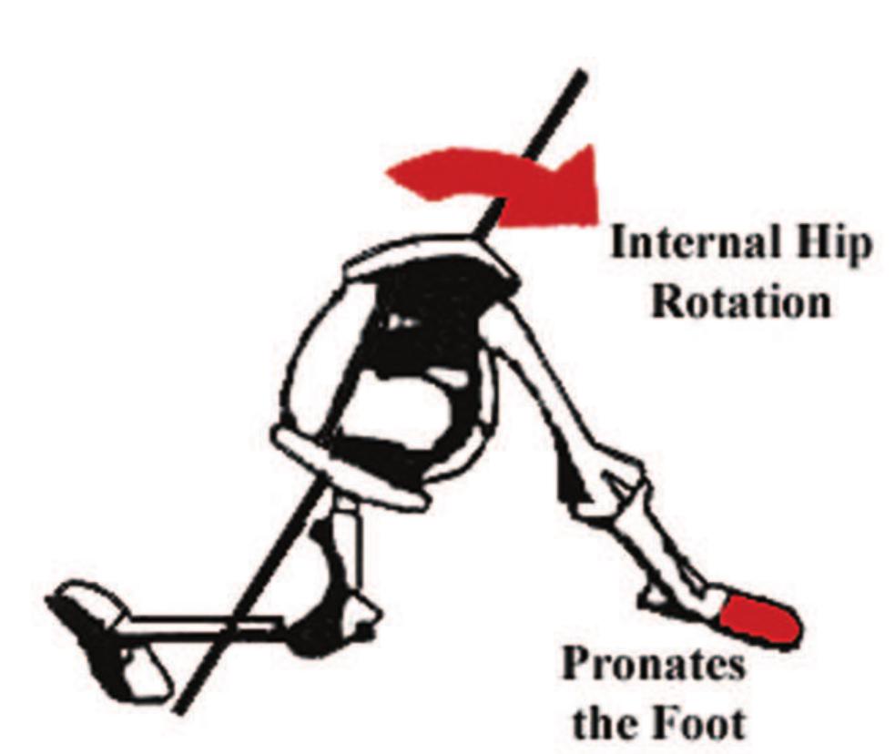 Pronation Internal Rotation (PDF) Vertical Facial Dimensions Linked to Abnormal Pronation