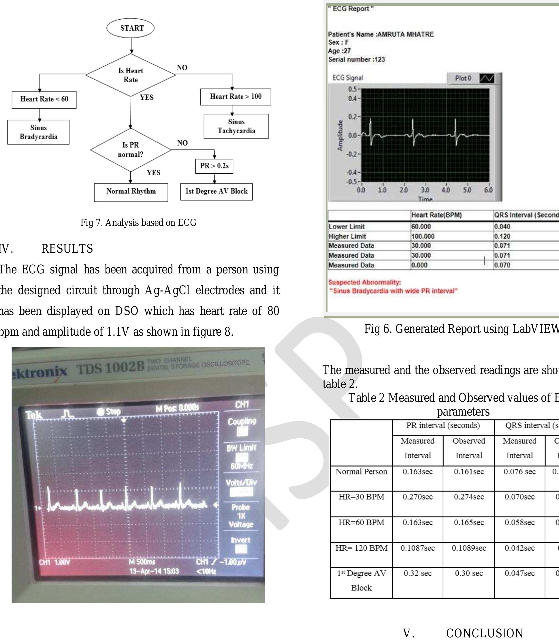 Labview Ecg (PDF) Temporal Analysis of ECG using LabVIEW