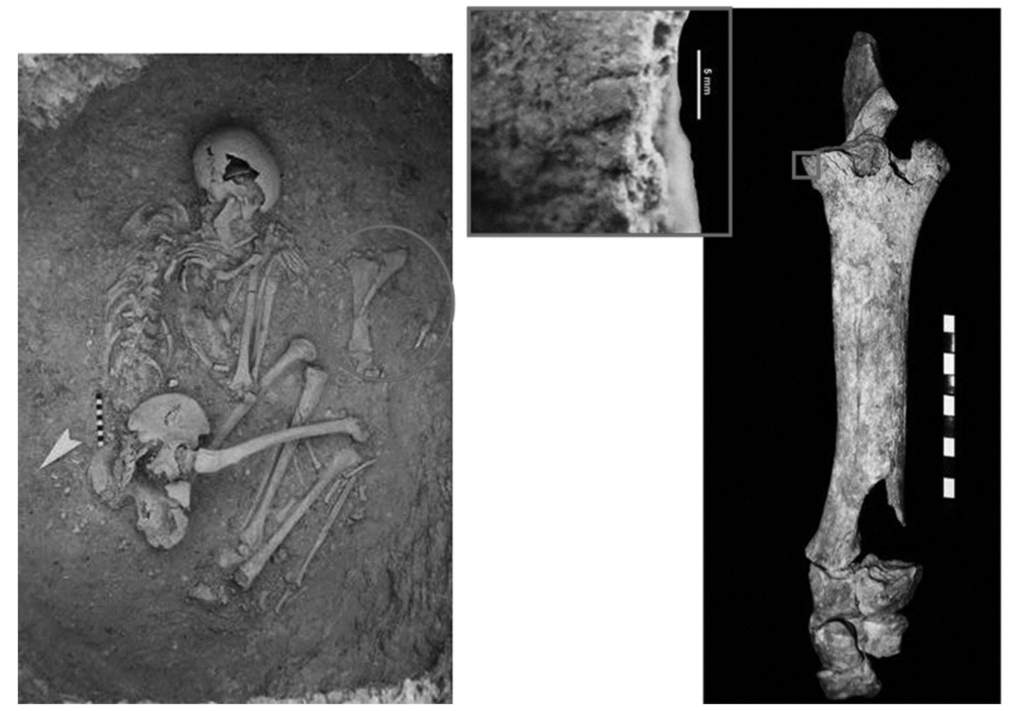 Figure 9 - Hypogeum 118 — Radius, ulna and carpals, with cut marks, associated to a female skeleton. 