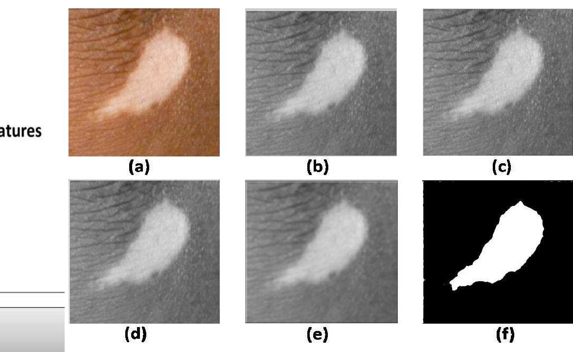 (PDF) Dermatological Disease Detection using Image Processing and ...
